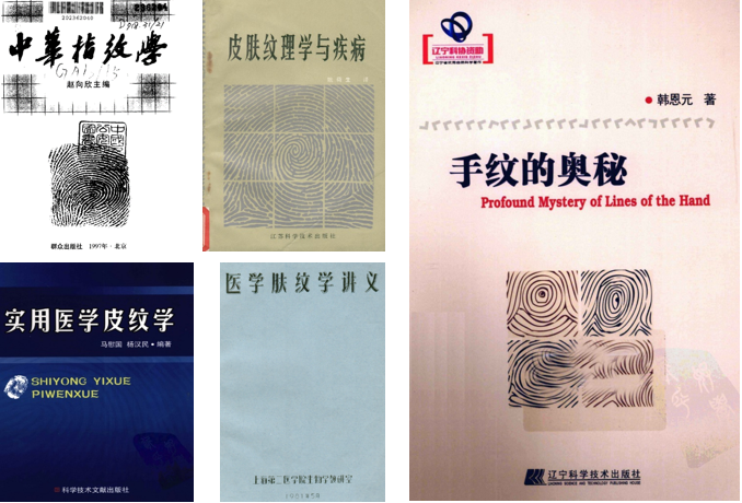 皇家迪智尼 I 揭开它神秘的面纱！指纹天赋测评到底是什么？